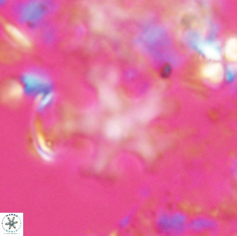 Discoaster leroyi 27736