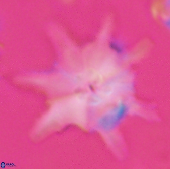 Discoaster limbatus 24948