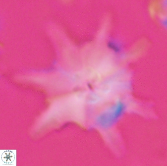 Discoaster limbatus 24948