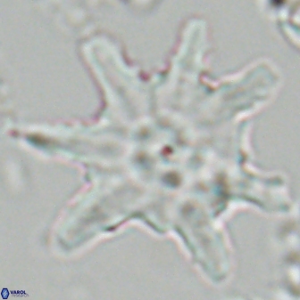 Discoaster limbatus 24949