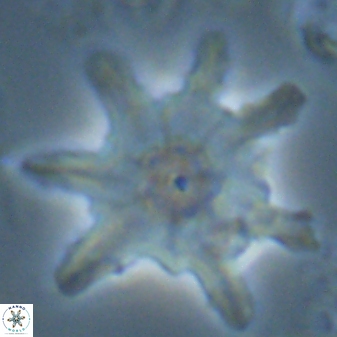 Discoaster limbatus 24955