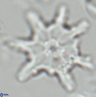 Discoaster limbatus 24951