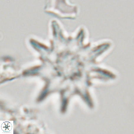 Discoaster limbatus 70673