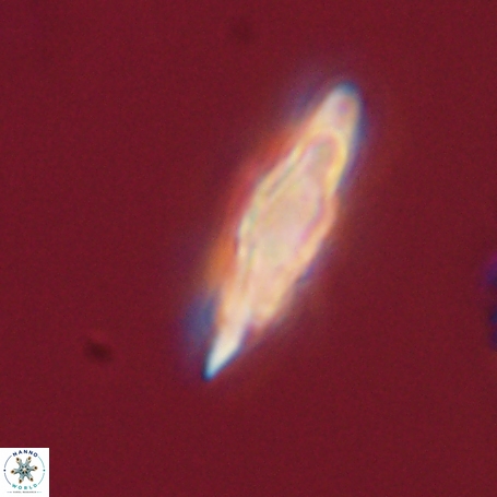 Discoaster limbatus 70684