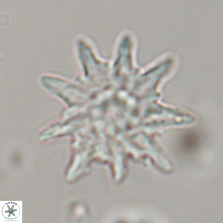 Discoaster limbatus 70694