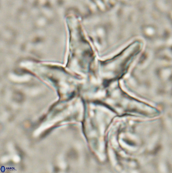 Discoaster lodoensis VR 025454