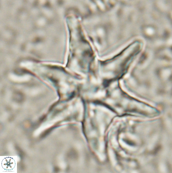 Discoaster lodoensis VR 025454