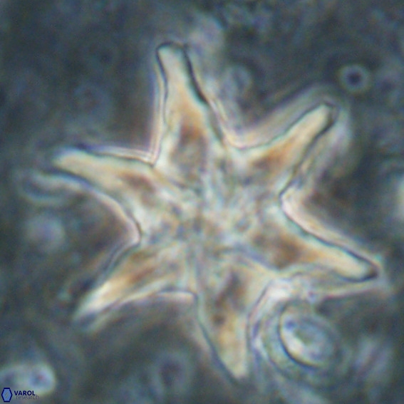 Discoaster lodoensis VR 025457