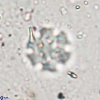 Discoaster pugliesei 13471