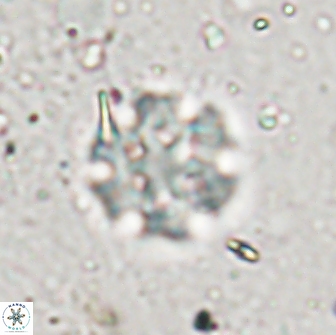 Discoaster pugliesei 13471