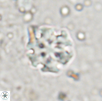 Discoaster pugliesei 13472