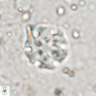 Discoaster pugliesei 13473