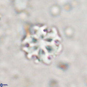 Discoaster pugliesei 13476