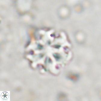 Discoaster pugliesei 13476