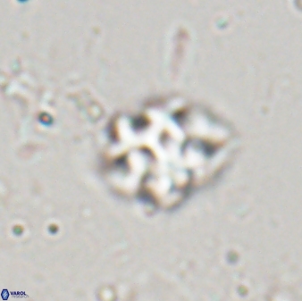 Discoaster pugliesei 29640