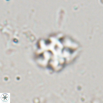 Discoaster pugliesei 29640