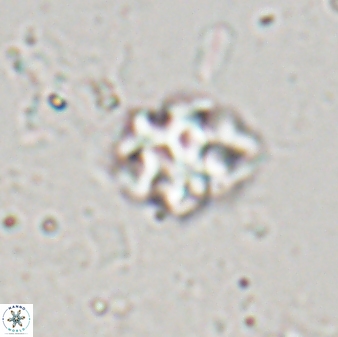 Discoaster pugliesei 29641