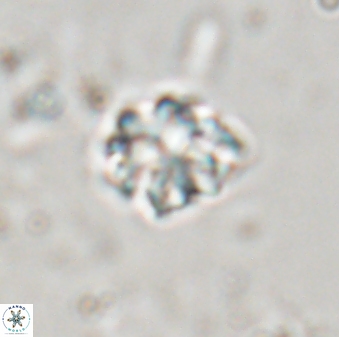 Discoaster pugliesei 29642