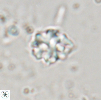 Discoaster pugliesei 29643