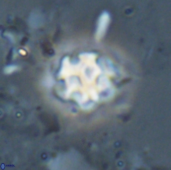 Discoaster pugliesei 29644