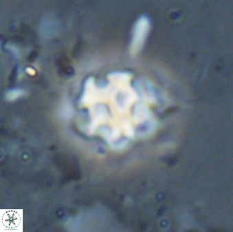 Discoaster pugliesei 29644