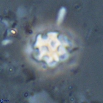 Discoaster pugliesei 29645