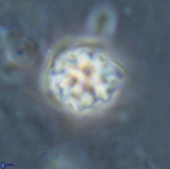 Discoaster pugliesei 29647