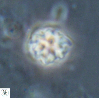 Discoaster pugliesei 29647