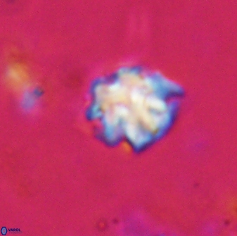 Discoaster pugliesei 29651