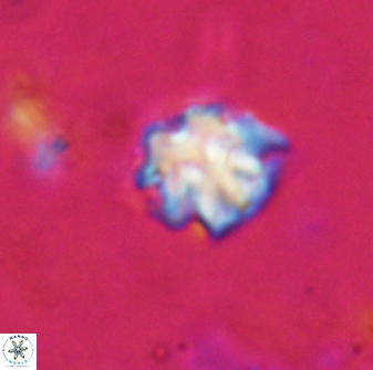 Discoaster pugliesei 29651