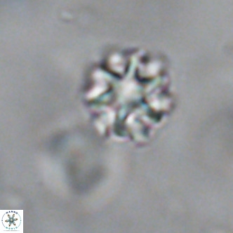 Discoaster puvillandii VR 18139