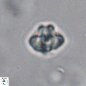 Discoaster puvillandii VR 18144