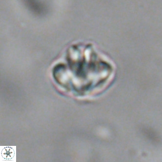 Discoaster puvillandii VR 18145