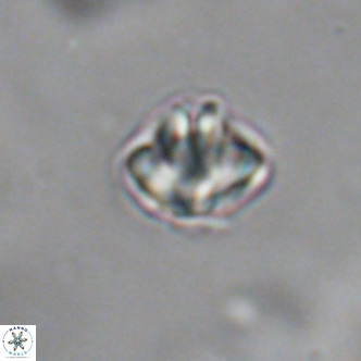 Discoaster puvillandii VR 18147