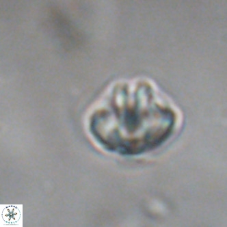 Discoaster puvillandii VR 18148