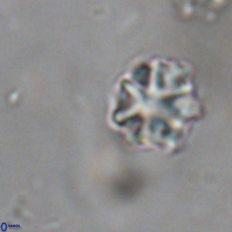 Discoaster puvillandii VR 18149