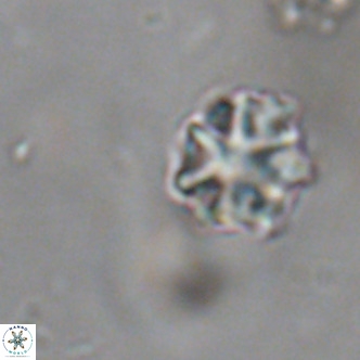 Discoaster puvillandii VR 18149