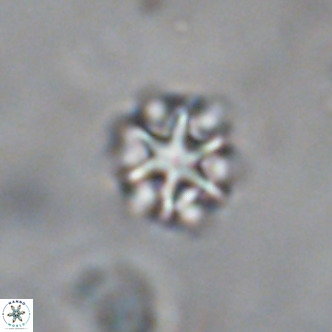 Discoaster puvillandii VR 18141