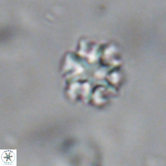 Discoaster puvillandii VR 18142