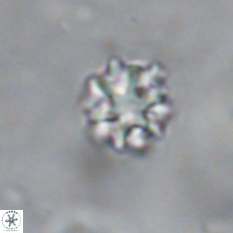 Discoaster puvillandii VR 18143