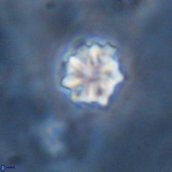 Discoaster puvillandii VR 18154