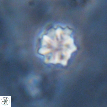 Discoaster puvillandii VR 18154