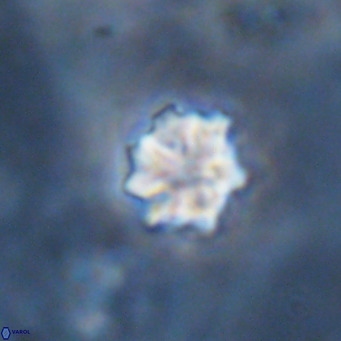 Discoaster puvillandii VR 18155