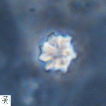 Discoaster puvillandii VR 18155
