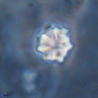 Discoaster puvillandii VR 18156