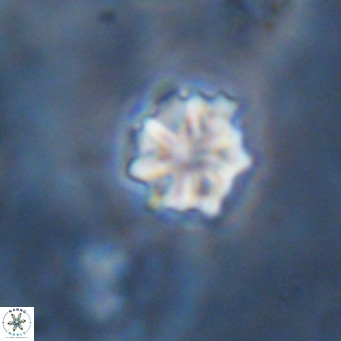Discoaster puvillandii VR 18156