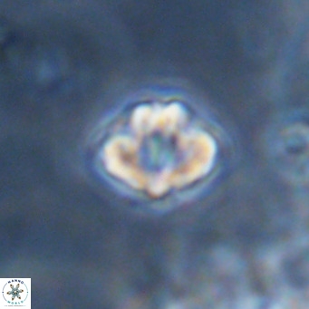 Discoaster puvillandii VR 18158