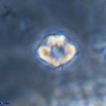 Discoaster puvillandii VR 18159