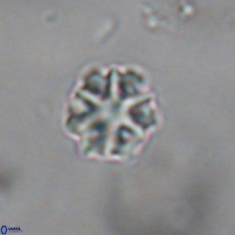 Discoaster puvillandii VR 18150