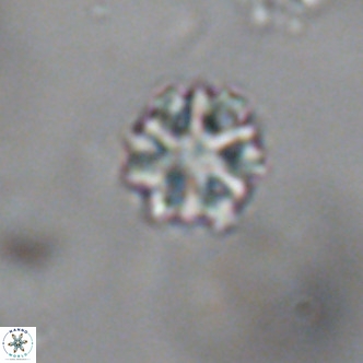 Discoaster puvillandii VR 18151
